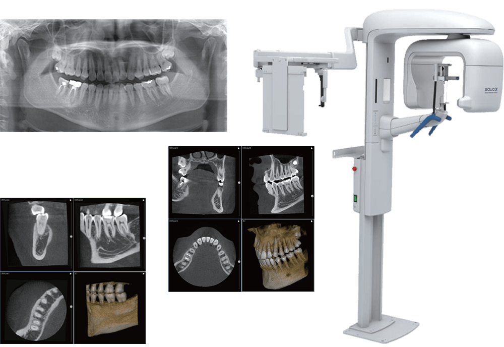 デジタルレントゲン・歯科用CT