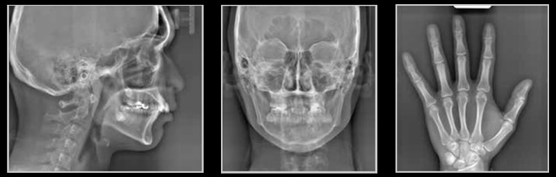 デジタルレントゲン・歯科用CT